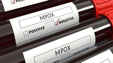 tsupaan sa twitter|Mpox cases rise to 16, death toll increase to three .